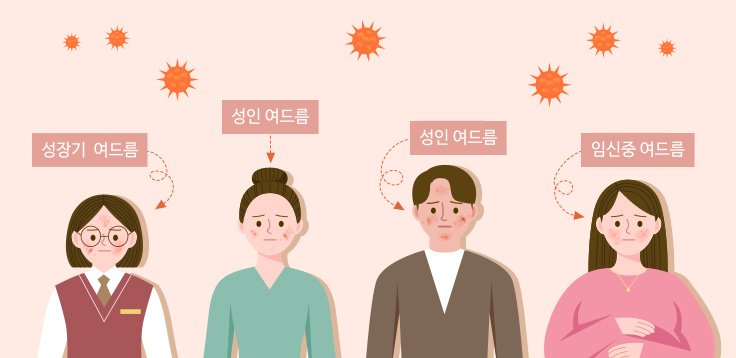 여드름